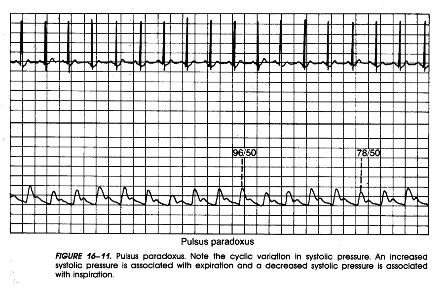 Hemodynamics